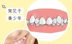 少一颗虎牙能做正畸矫正吗？