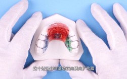 正畸时使用的牙齿产品有哪些？如何判断其安全性、有效性及适用人群，避免使用误区？