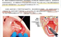 针对不同牙齿（前牙、后牙、乳牙、恒牙），麻醉方法应如何精准选择？注射部位与药物应用有何差异？