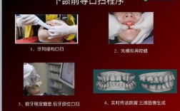 全口牙咬蜡方法的具体操作步骤有哪些？