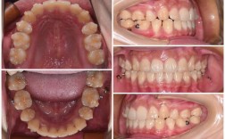 福州正畸梁甲兴靠谱吗？