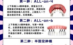 颌面外科能开展种植牙吗？需要满足什么条件？