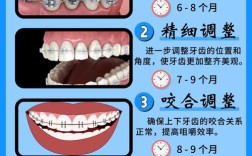正畸治疗中磨牙升高的具体方法有哪些？