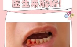 种牙动脉大出血，风险从何而来？如何避免致命伤害？