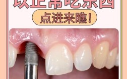 牙博士种牙医生怎么选？专业实力哪家强？