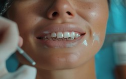 矫正牙齿到底痛不痛？矫正过程会有多难受？需要忍耐多久？