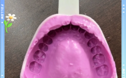 取牙模的方法有哪些？具体步骤及注意事项有哪些？