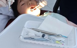 种牙拆线后几天能喝酒？