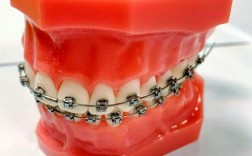 国产正畸托槽品牌该怎么选？