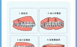 正畸治疗中，患者可以自行携带支抗钉吗？这种做法是否安全有效，又会对矫正效果产生哪些影响？