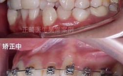 南京矫正牙齿哪家好