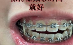 直接用保持器矫正牙齿，可行吗？效果与风险如何？