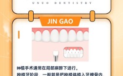 拔牙之后多久可以种牙