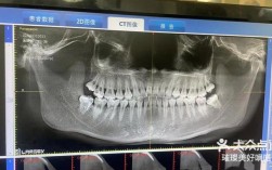 口腔正畸X光片有何关键作用？