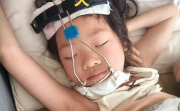 正畸牙齿矫正器儿童图片