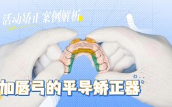 正畸平导3d演示