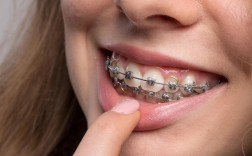 尖牙矫正视频能真实展示矫正过程和效果吗？