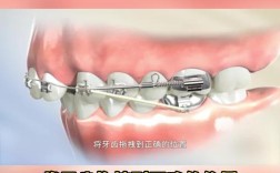 补过的牙齿可以矫正吗