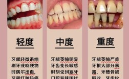 牙龈萎缩可以种牙