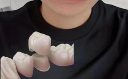 种牙之后戴牙冠会疼吗？戴牙冠的过程会有疼痛感吗？