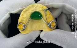 shiye牙齿矫正器矫正效果真的靠谱吗？使用体验如何？