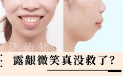 深圳北大正畸失败，责任究竟谁来担？