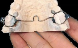 正畸TPA需要一直佩戴吗？