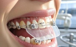 30岁矫正牙齿还来得及吗？效果会比年轻人差吗？