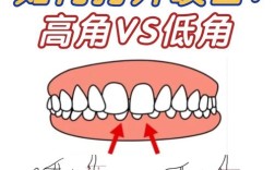 牙齿咬合不齐矫正有哪些常用方法？