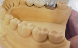 拜博口腔医院假牙安装