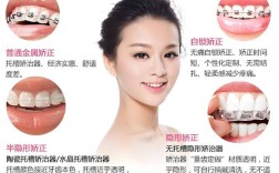 矫正牙齿哪种方式最适合自己？