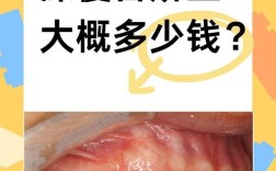 深圳哪里的矫正牙齿好