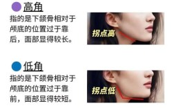 口腔正畸中u是指上颌还是下颌？求专业解答