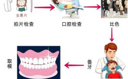 前牙贴面的预备方法