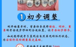 矫正牙齿戴牙套，一般需要戴几年？