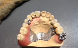 吴江口腔正畸支架矫正效果如何？安全吗？怎么选？