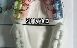 正畸推簧什么时候用