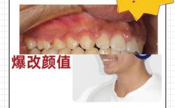 佛山市口腔医院进修正畸项目具体有何优势？效果与服务怎么样？