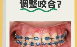 矫正期间咬合关系异常该如何调整？