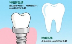贵阳种牙费用一颗大概多少钱？影响因素有哪些？
