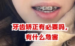 矫正牙齿后复发几率高不高？