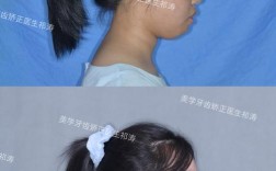 牙齿不齐却无法正畸，究竟是什么原因？