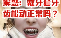 牙齿矫正真的会让牙齿松动吗？矫正期间和矫正后会怎样？