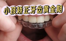 深圳 儿童牙齿正畸