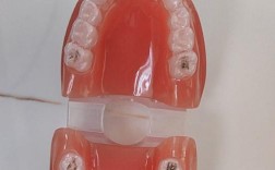 牙齿矫正之后带保持器