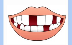 缺了哪颗牙一定要种