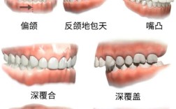 正畸骨性畸形分类的临床意义与标准是什么？