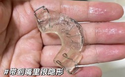 北口地包天术前正畸