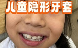 青少年隐形牙齿矫正