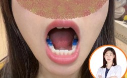 正畸关闭间隙后还要多久完成矫正？